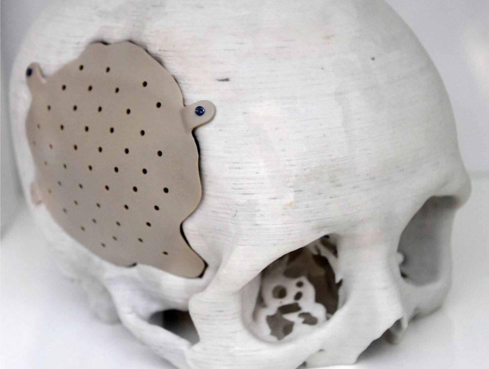 �@������ɫ�ĸ�ˎ��������Ŀ��������3D��ӡ���XĤ��